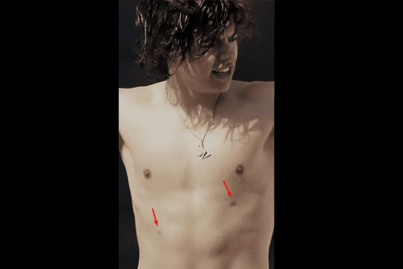 Harry has an unusual feature on his body.jpg?format=webp